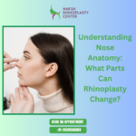 Rhinoplasty