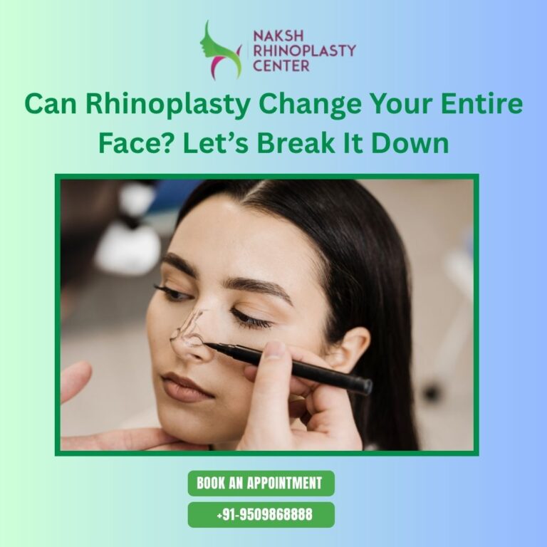 Rhinoplasty