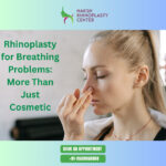 Rhinoplasty