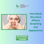 rhinoplasty