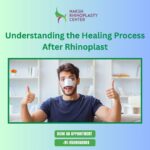 Rhinoplasty