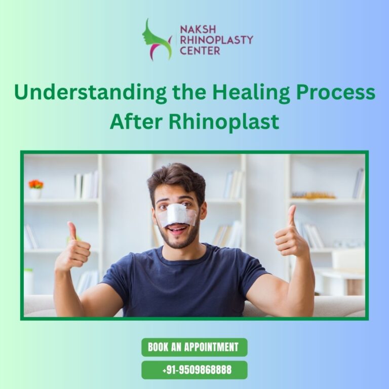 Rhinoplasty